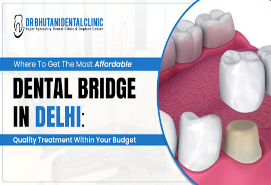 Dental Bridges Cost In Delhi,BC