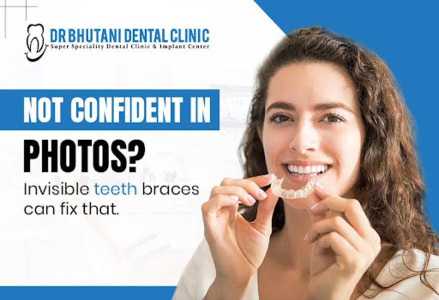 Invisible Teeth Braces In Delhi