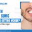 Gum Treatment