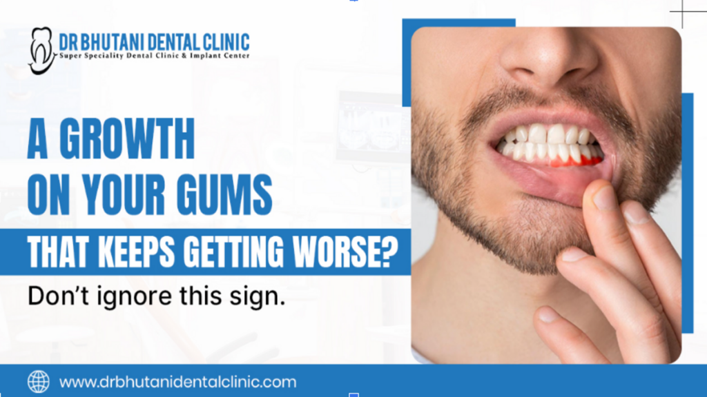 gum disease treatment