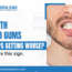 Gum Disease Treatment