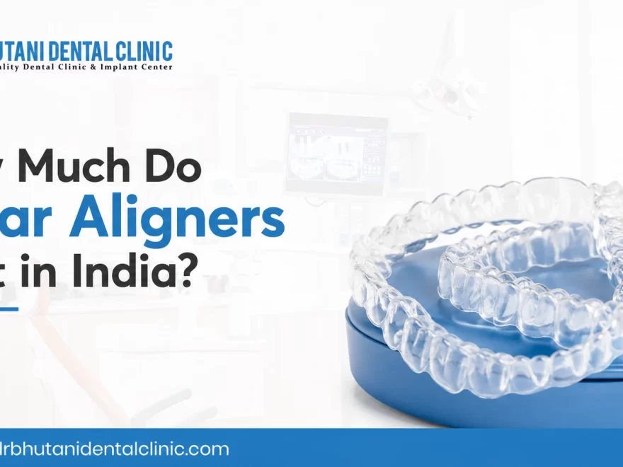 Clear Aligners Displayed With The Headline “How Much Do Clear Aligners Cost In India?” By Dr Bhutani Dental Clinic