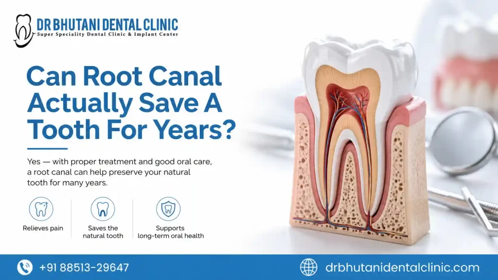 Root Canal Dentist