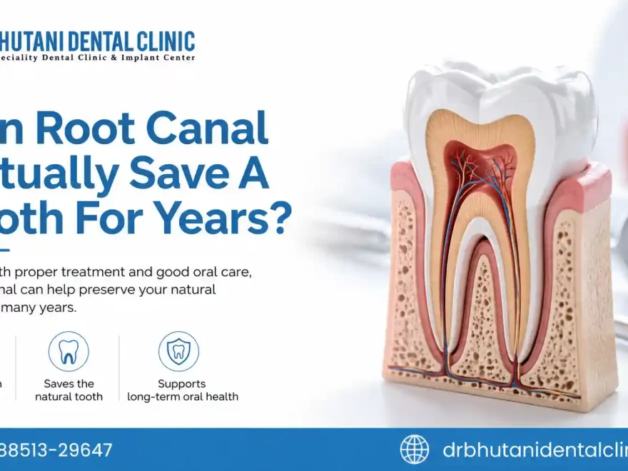 Root Canal Dentist