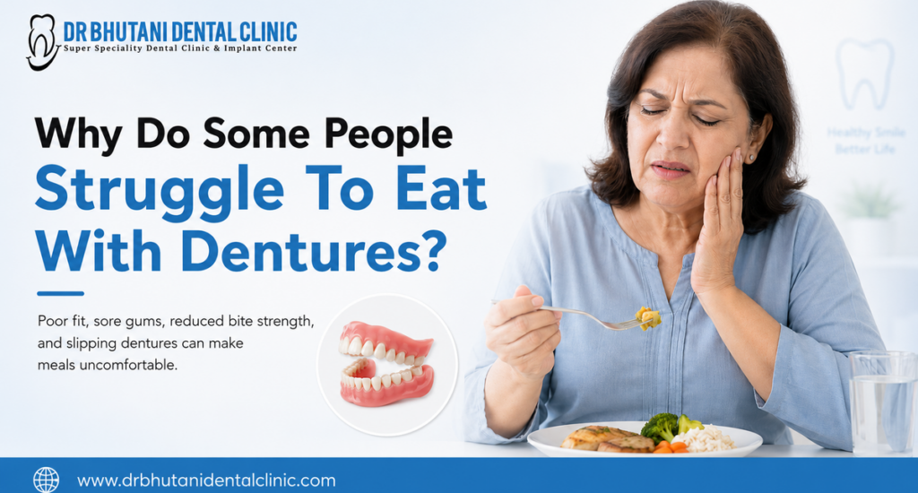 Full Mouth Dental Implants
