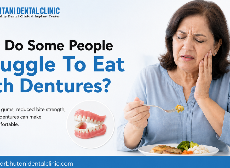 Full Mouth Dental Implants
