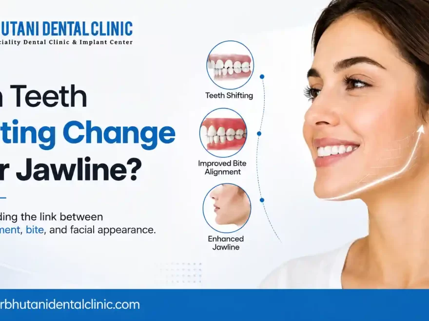 Braces Cost In Delhi