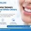 Veneers