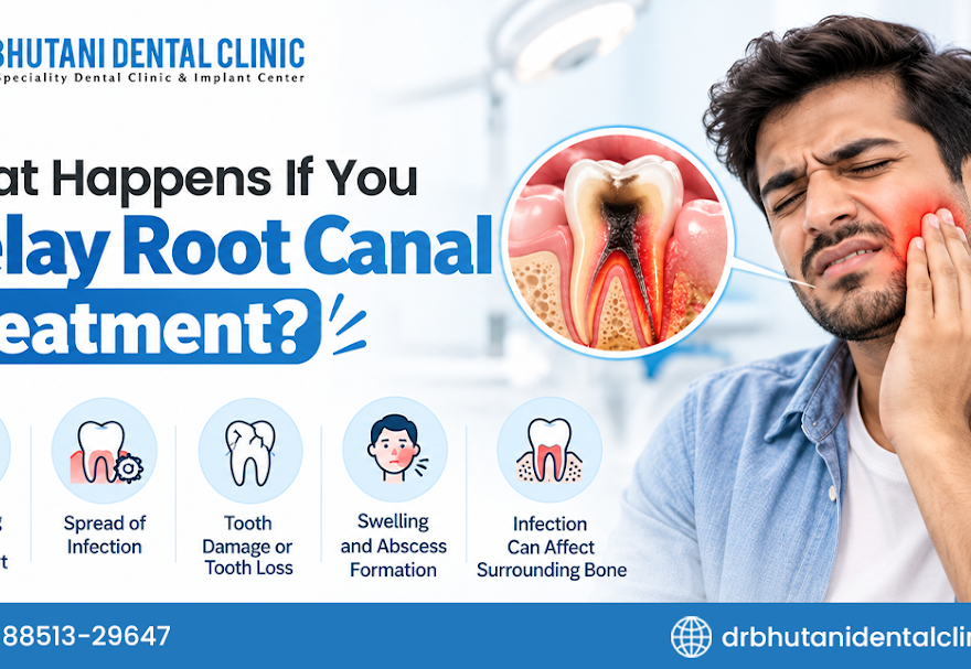 Root Canal Treatment